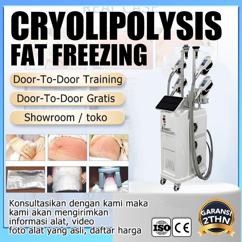 Crissty BeautyMe Cryolipolysis fat freezing machine